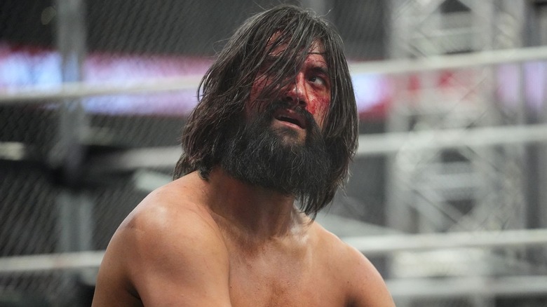 Wheeler Yuta with blood on his face