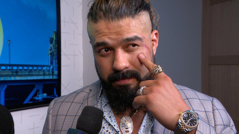 Andrade pointing to his face