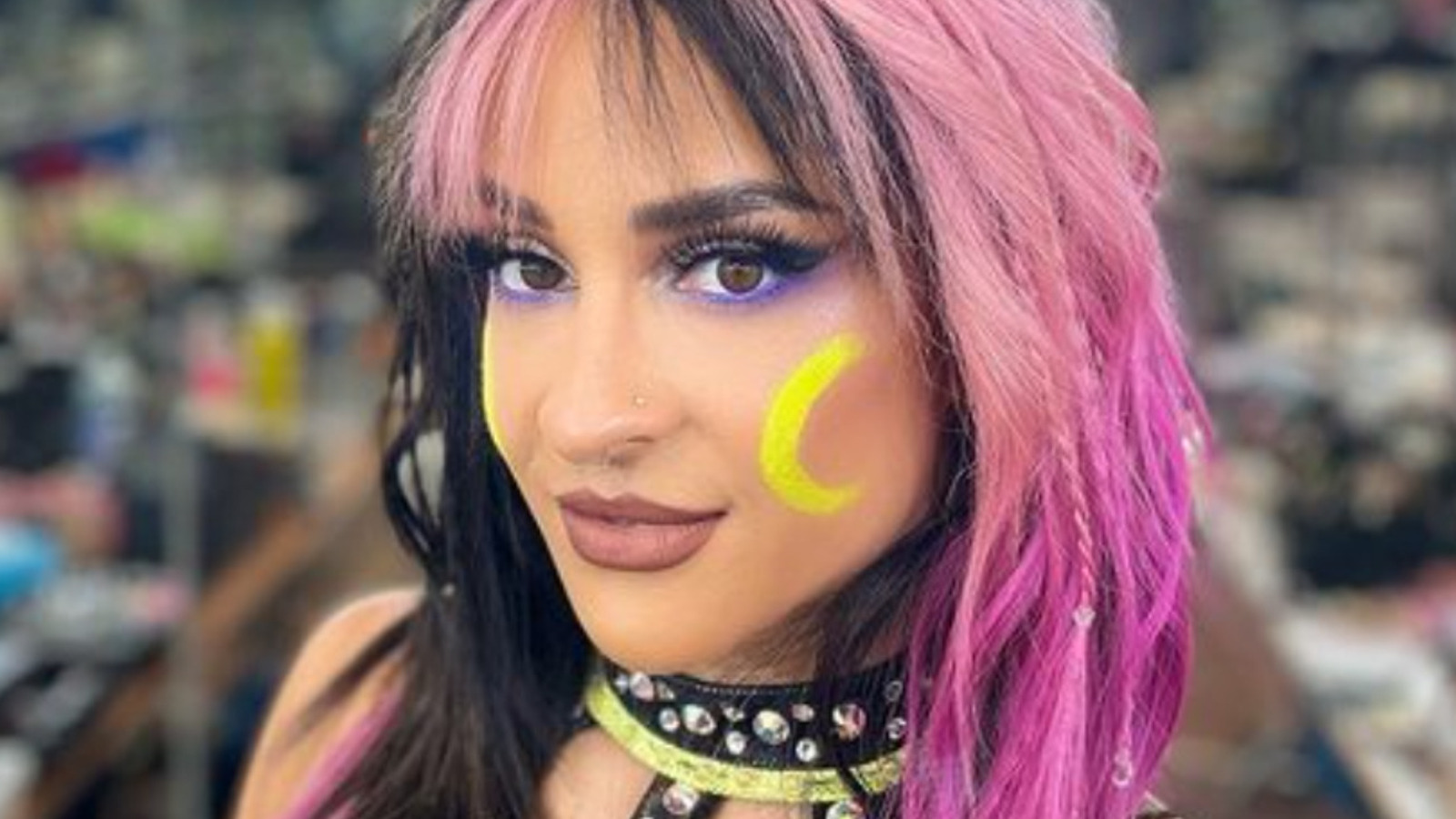 Dakota Kai Provides Update Following ACL Surgery Last Month - Vimarsana News