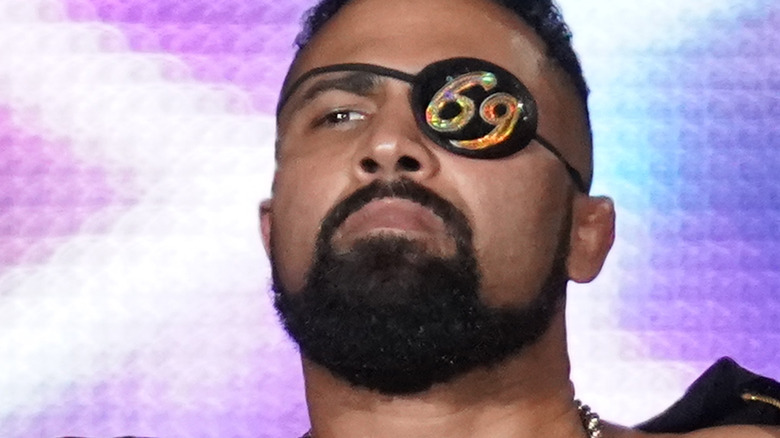 Rocky Romero wearing eyepatch