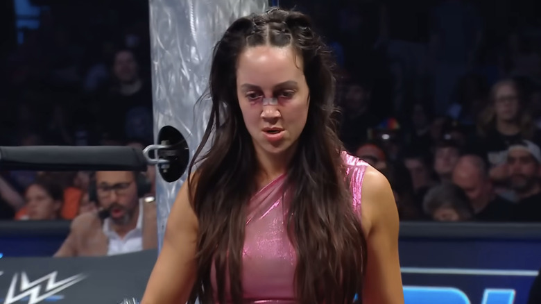 Chelsea Green, sporting a broken nose